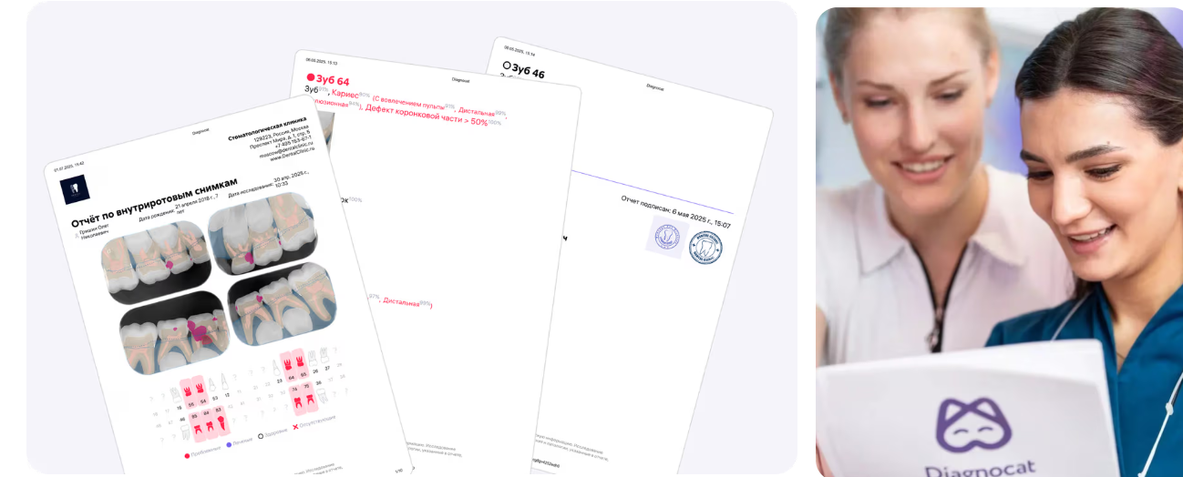 Точная диагностика с искусственным интеллектом «Diagnocat»